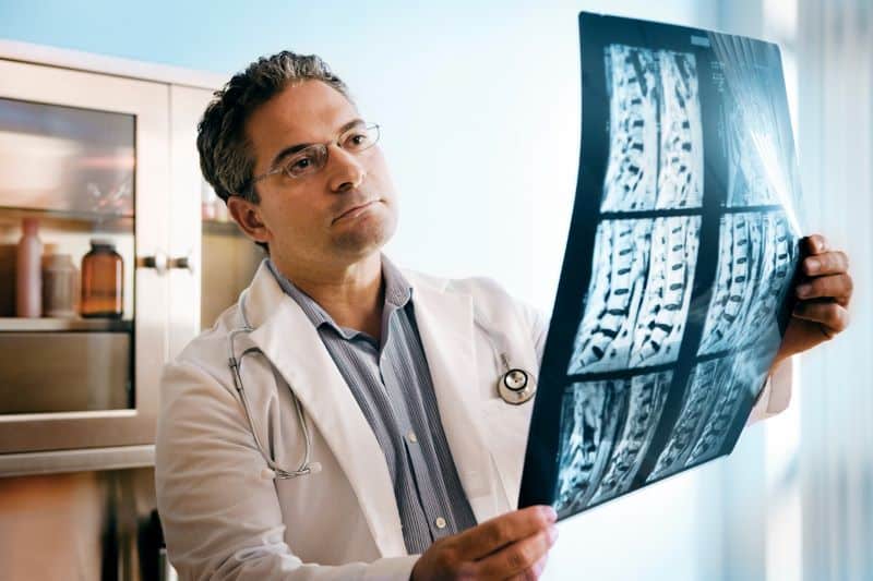 doctor looking at spinal cord mri to diagnose patient