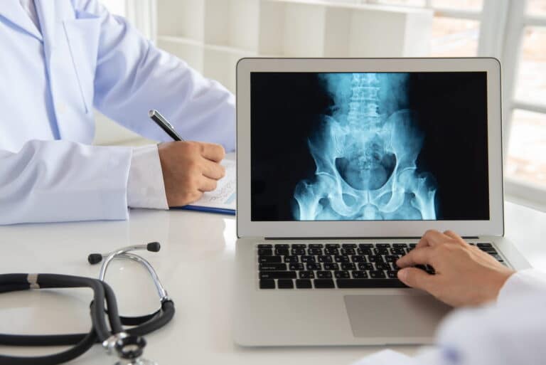 A doctor reviewing a spinal cord injury X-ray on his laptop.