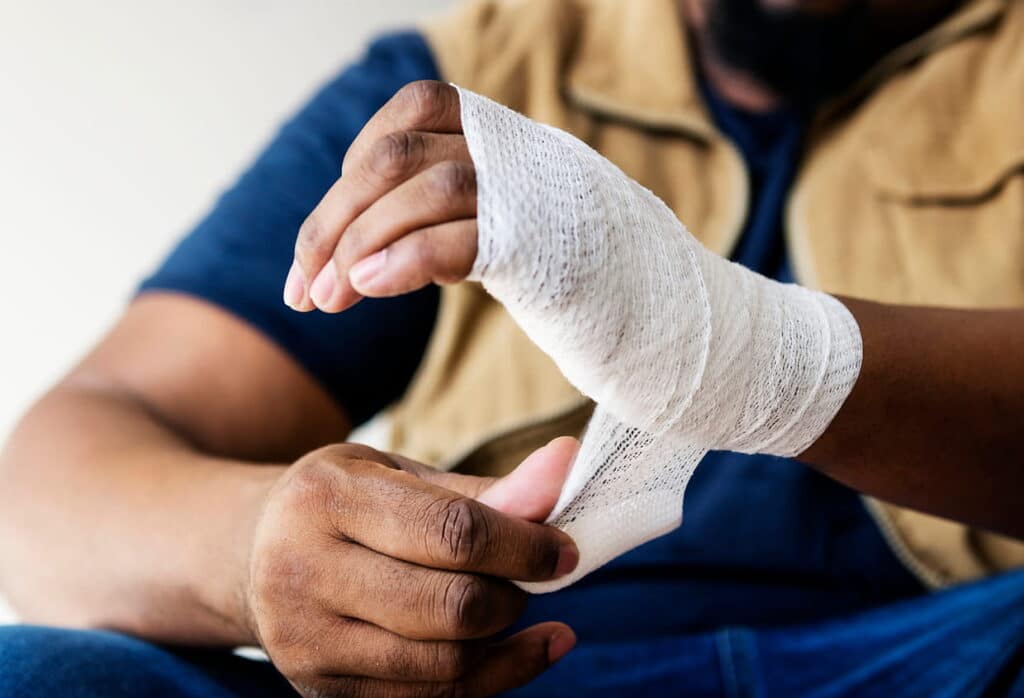 A man with his hand wrapped in gauze after suffering a burn work injury.