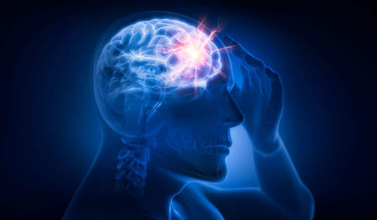 A 3D illustration for a brain injury.